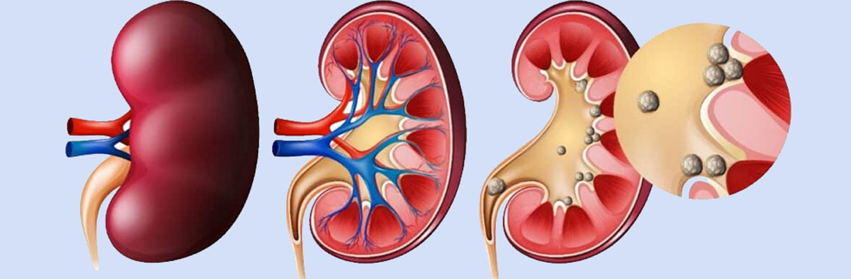A large kidney organ in the abdomen, essential for filtering blood and producing urine.