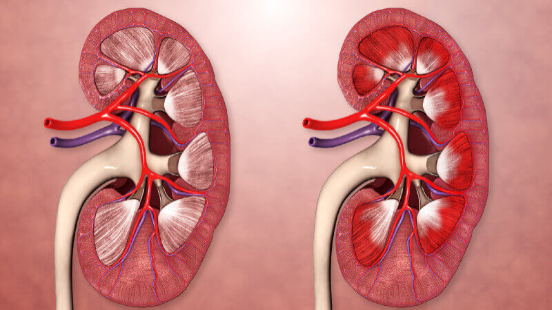 A visual representation of the kidney shown in two different positions for educational purposes.